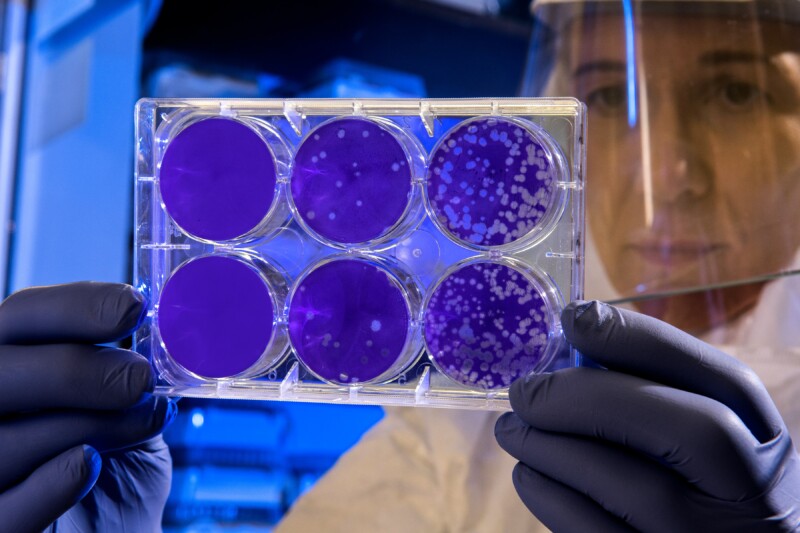 woman-scientist-examines-results-virus-medicine